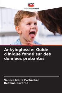 Produktbild: Ankyloglossie: Guide clinique fond&eacute; sur des donn&eacute;es probantes