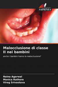 Produktbild: Malocclusione di classe II nei bambini