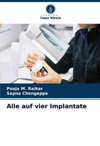 Produktbild: Alle auf vier Implantate