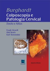 Produktbild: Burghardt - colposcopia e patologia cervical