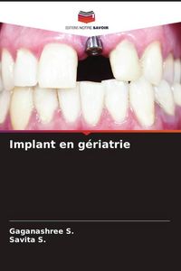 Produktbild: Implant en g&eacute;riatrie