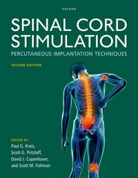 Produktbild: Spinal Cord Stimulation