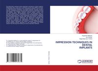 Produktbild: Impression Techniques in Dental Implants