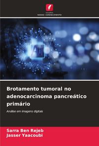 Produktbild: Brotamento tumoral no adenocarcinoma pancre&aacute;tico prim&aacute;rio