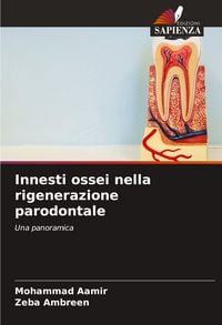 Produktbild: Innesti ossei nella rigenerazione parodontale