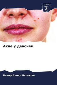 Produktbild: Akne u dewochek