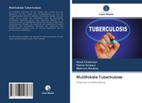 Produktbild: Multifokale Tuberkulose
