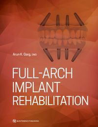 Produktbild: Full-Arch Implant Rehabilitation