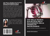 Produktbild: Uso Della Tecnica Hla-B27pcr Per Il Rilevamento Della Spondilite Anchilosante