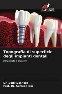 Produktbild: Topografia di superficie degli impianti dentali