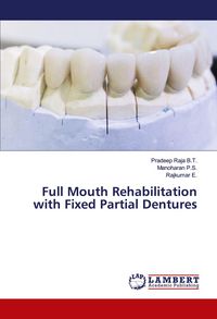 Produktbild: Full Mouth Rehabilitation with Fixed Partial Dentures
