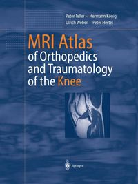 Produktbild: MRI Atlas of Orthopedics and Traumatology of the Knee