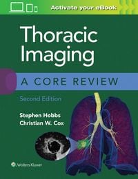 Produktbild: Cox, C: Thoracic Imaging: A Core Review