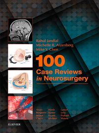Produktbild: 100 Case Reviews in Neurosurgery E-Book
