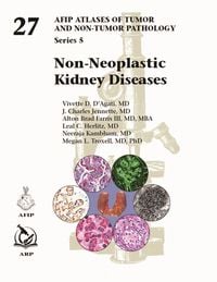Produktbild: Non-Neoplastic Kidney Diseases