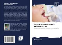 Produktbild: Nauka o dental'nyh implantatah