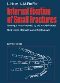 Produktbild: Internal Fixation of Small Fractures
