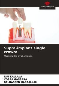 Produktbild: Supra-implant single crown: