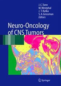 Produktbild: Neuro-Oncology of CNS Tumors