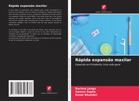 Produktbild: R&aacute;pida expans&atilde;o maxilar