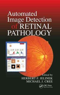 Produktbild: Jelinek, H: Automated Image Detection of Retinal Pathology