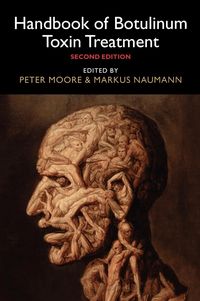 Produktbild: Handbook of Botulinum Toxin Treatment