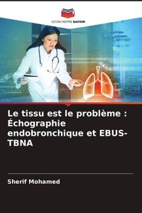 Produktbild: Le tissu est le probl&egrave;me : &Eacute;chographie endobronchique et EBUS-TBNA