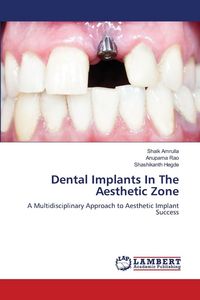 Produktbild: Dental Implants In The Aesthetic Zone