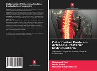 Produktbild: Osteotomias Ponte em Artrodese Posterior Instrument&aacute;ria