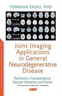 Produktbild: Zhou, Y: Joint Imaging Applications in General Neurodegenera
