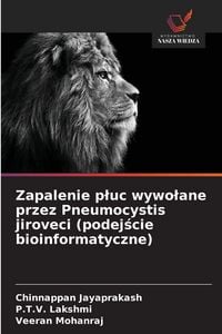 Produktbild: Zapalenie p&iquest;uc wywo&iquest;ane przez Pneumocystis jiroveci (podej&iquest;cie bioinformatyczne)