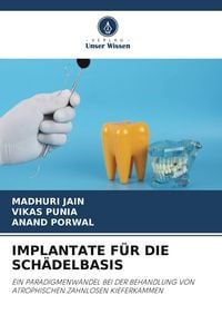 Produktbild: IMPLANTATE F&Uuml;R DIE SCH&Auml;DELBASIS