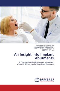 Produktbild: An Insight into Implant Abutments