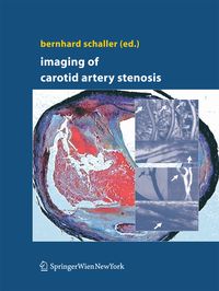 Produktbild: Imaging of Carotid Artery Stenosis