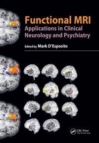 Produktbild: Functional MRI