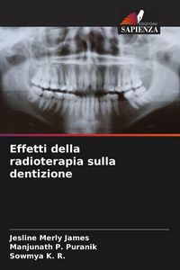 Produktbild: Effetti della radioterapia sulla dentizione