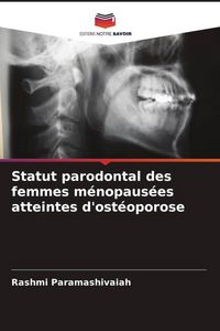 Produktbild: Statut parodontal des femmes m&eacute;nopaus&eacute;es atteintes d'ost&eacute;oporose
