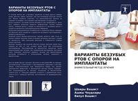 Produktbild: Varianty Bezzubyh Rtov S Oporoj Na Implantaty