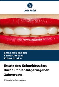 Produktbild: Ersatz des Schneidezahns durch implantatgetragenen Zahnersatz