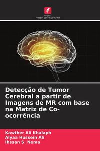 Produktbild: Detec&ccedil;&atilde;o de Tumor Cerebral a partir de Imagens de MR com base na Matriz de Co-ocorr&ecirc;ncia