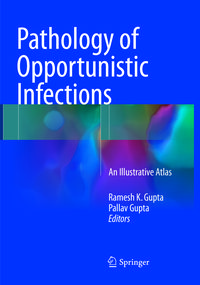 Produktbild: Pathology of Opportunistic Infections