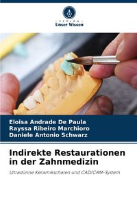 Produktbild: Indirekte Restaurationen in der Zahnmedizin