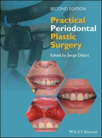 Produktbild: Practical Periodontal Plastic Surgery