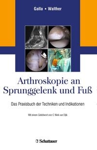 Produktbild: Arthroskopie an Sprunggelenk und Fu&szlig;