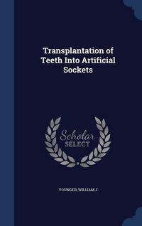 Produktbild: Transplantation of Teeth Into Artificial Sockets