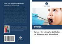 Produktbild: Karies - Ein klinischer Leitfaden zur Diagnose und Behandlung