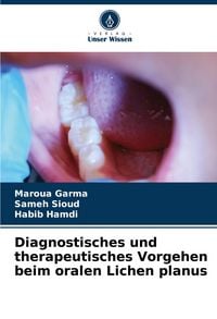 Produktbild: Diagnostisches und therapeutisches Vorgehen beim oralen Lichen planus