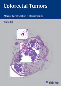 Produktbild: Colorectal Tumors