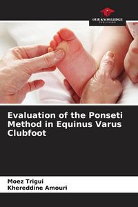 Produktbild: Evaluation of the Ponseti Method in Equinus Varus Clubfoot