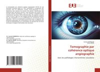 Produktbild: Tomographie par coh&eacute;rence optique angiographie
